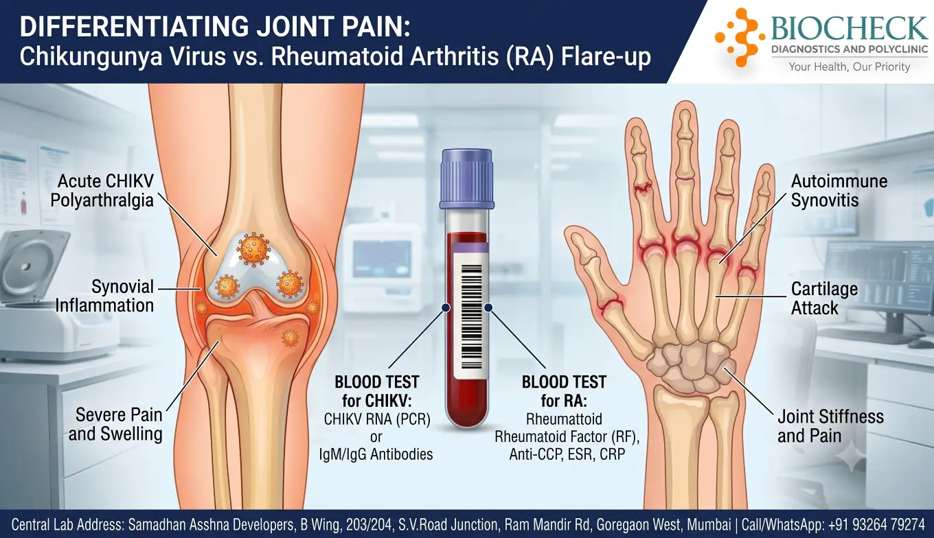 Biocheck Diagnostics And Polyclinic Blogs - A split medical graphic showing the inflammatory joint effects of the Chikungunya virus on the left, compared to an autoimmune Rheumatoid Arthritis flare-up on the right, centered around a clinical laboratory blood tube.