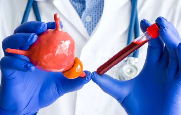 Biocheck Diagnostics And Polyclinic - Autoimmune Tests Image