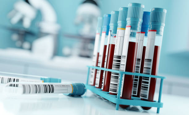 Biocheck Diagnostics And Polyclinic - Hematology Tests Image