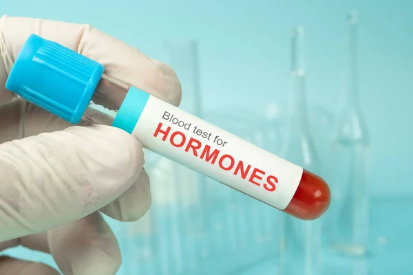 Biocheck Diagnostics And Polyclinic - Hormones Tests Image