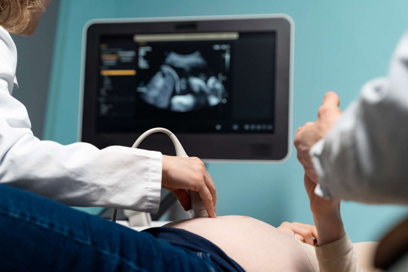 Biocheck Diagnostics And Polyclinic - Sonography Tests Image