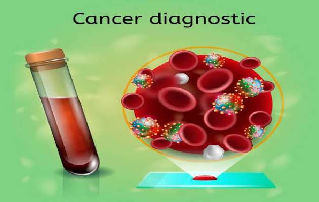 Biocheck Diagnostics And Polyclinic - Tumor Marker Tests Image